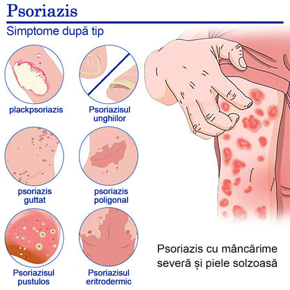 🐝🐝 Piguay ™  Cremă antibacteriană cu venin de albine (potrivită pentru toate tipurile de piele)