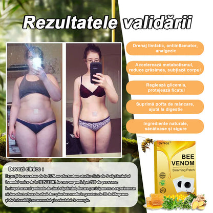 👩🏻‍⚕️👩🏻‍⚕️Cvreoz™ plasture de slăbire cu venin de albine⭐(pentru toate problemele limfatice și obezitate)