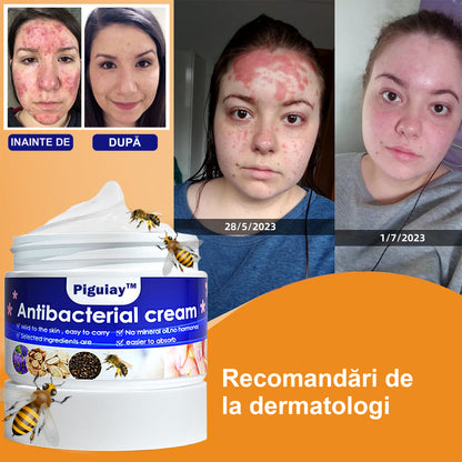 🐝🐝 Piguay ™  Cremă antibacteriană cu venin de albine (potrivită pentru toate tipurile de piele)