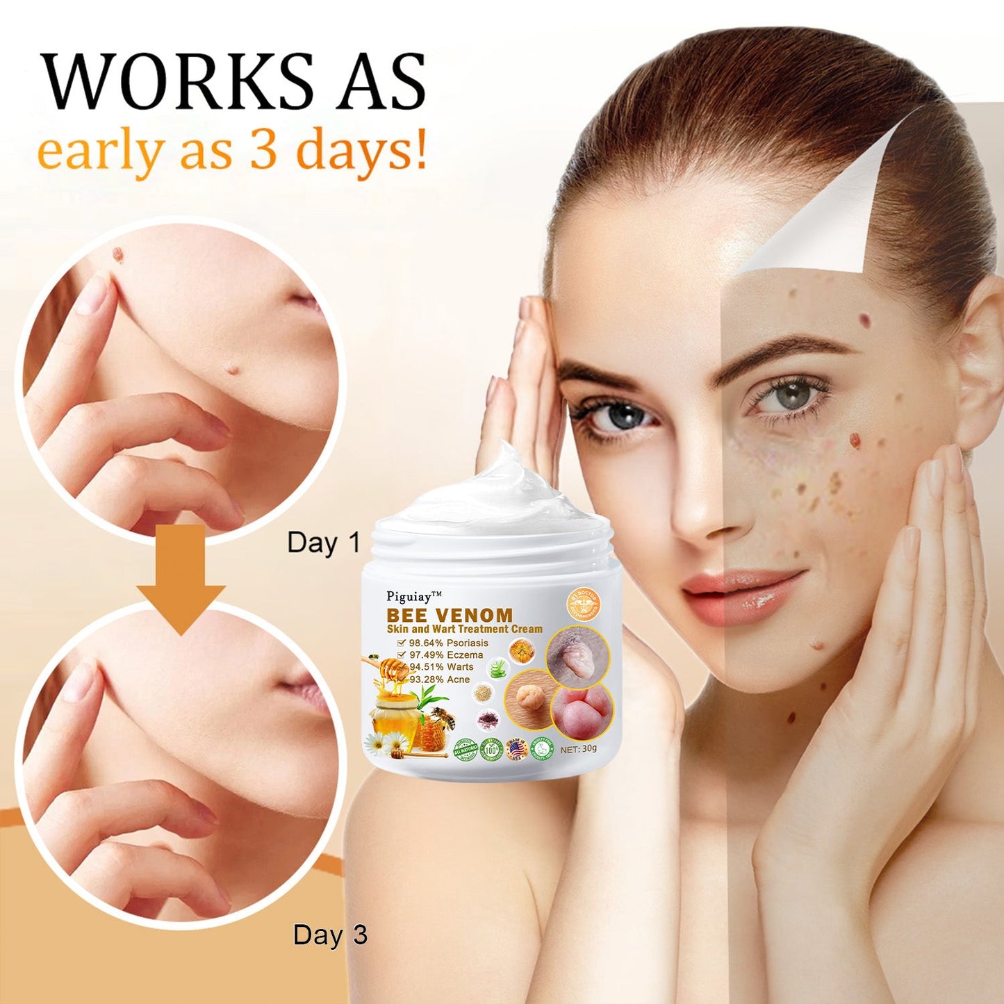 🌿🌿𝐏𝐢𝐠𝐮𝐢𝐚𝐲™ Bee Venom Wart & Tag Removal Cream(👨‍⚕Suitable for all skin types)🐝(🔥Last day promotion 60% off)