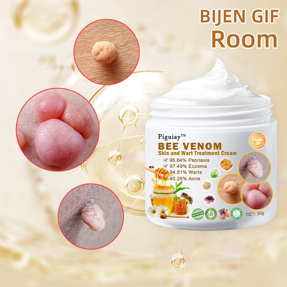 🌿🌿𝐏𝐢𝐠𝐮𝐢𝐚𝐲™ Bee Venom Wart & Tag Removal Cream(👨‍⚕Suitable for all skin types)🐝(🔥Last day promotion 60% off)